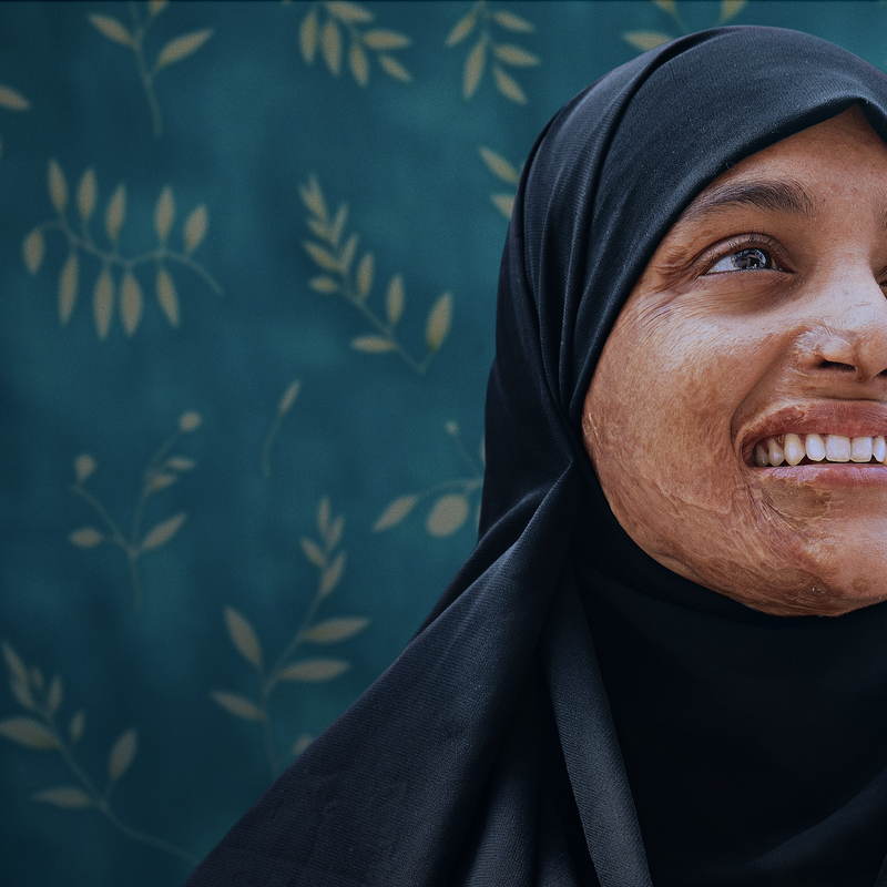 {{
                tmp_photo.alt }}